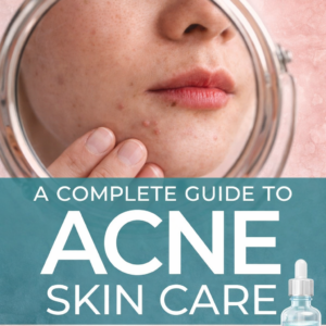 a complete guide to acne skin care