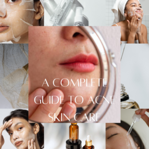 natural remedies for acne treatment