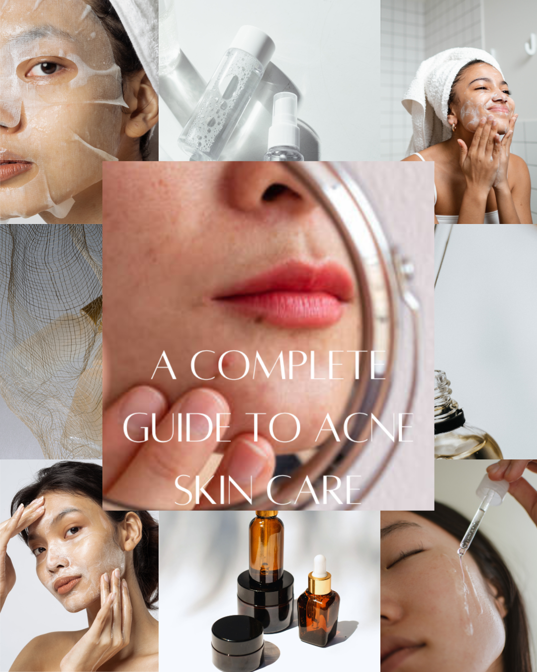 natural remedies for acne treatment